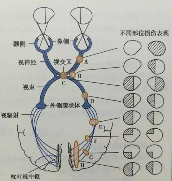 三偏征 快懂百科