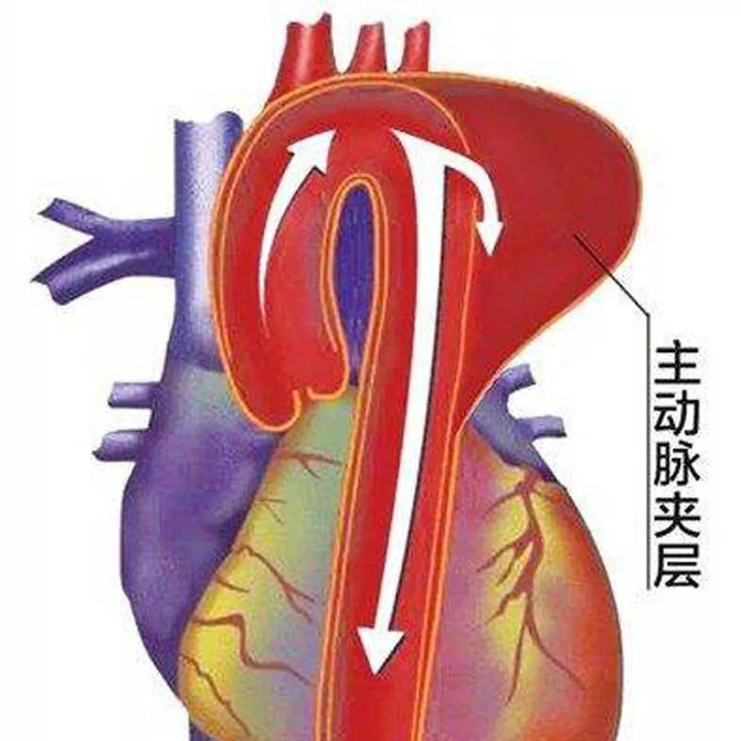 图13-7 右冠状动脉-胸心外科临床解剖学-医学