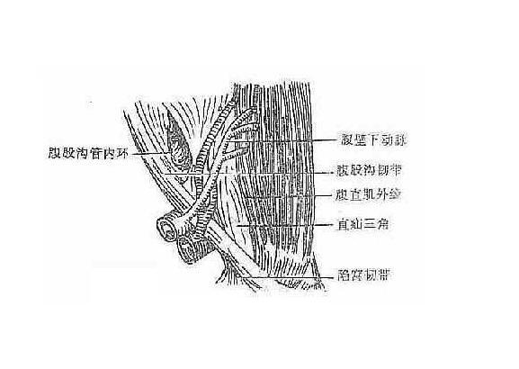 腹股沟三角