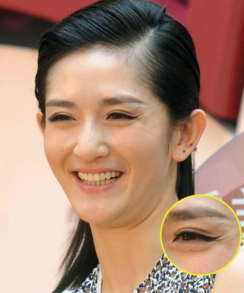 笑纹 头条百科