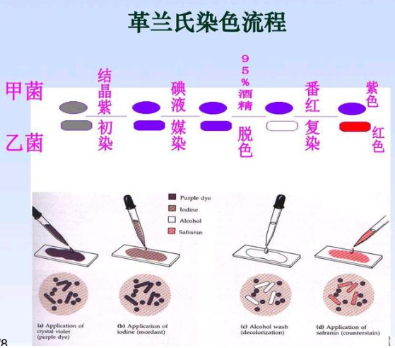 革兰氏染色 快懂百科