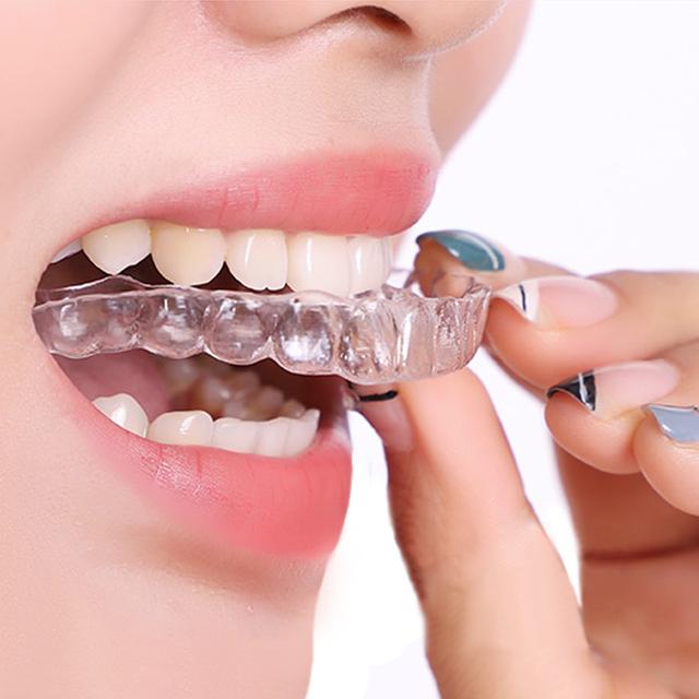 隐形牙套 快懂百科