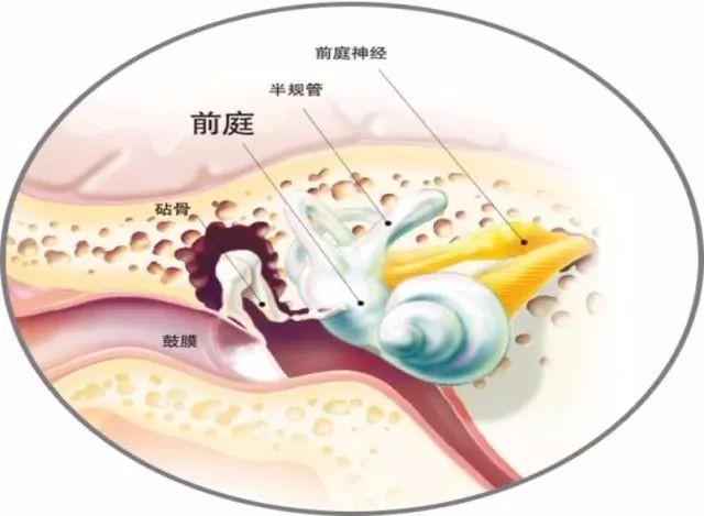 前庭疾患治療: 前庭神経炎 めまい残る – CJDJDC