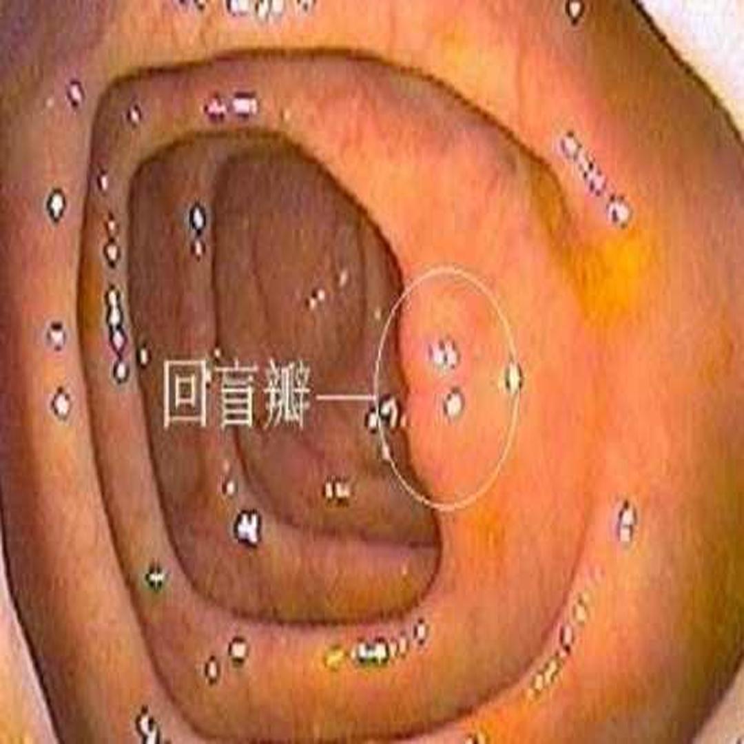 回盲部 头条百科