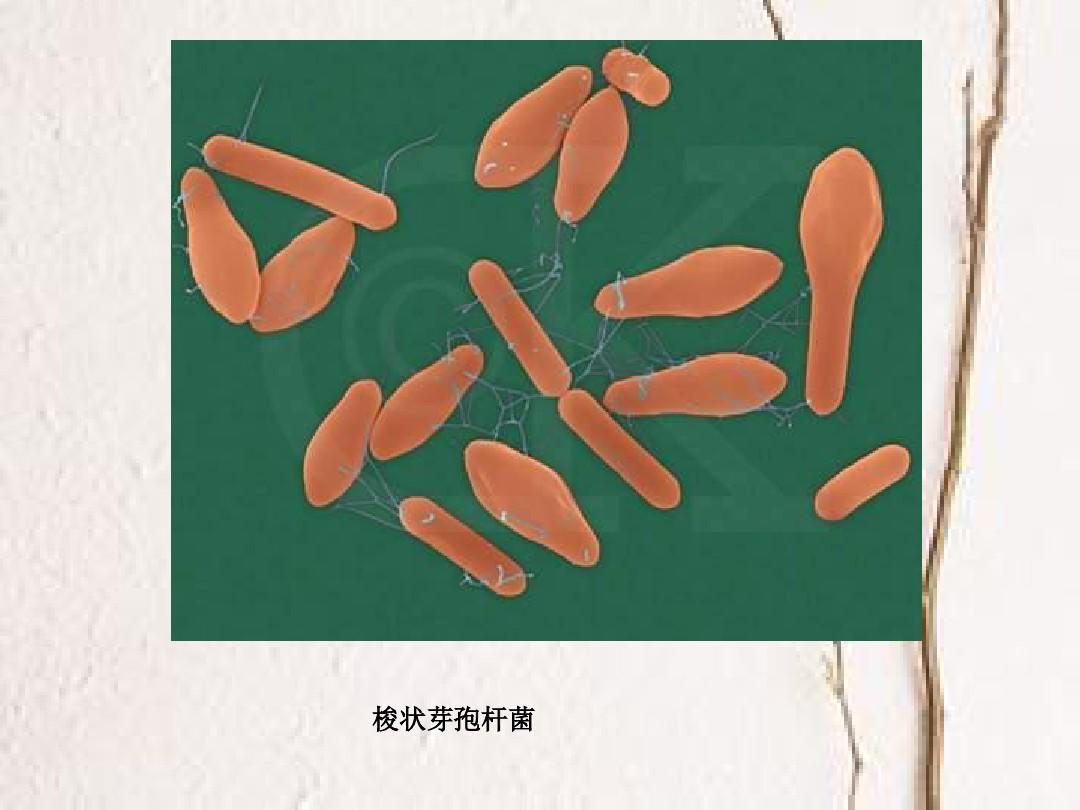 丁酸梭菌高清无码图--来自金百合生物_丁酸梭菌|丁酸梭菌联合发酵|微生态制剂-金百合生物