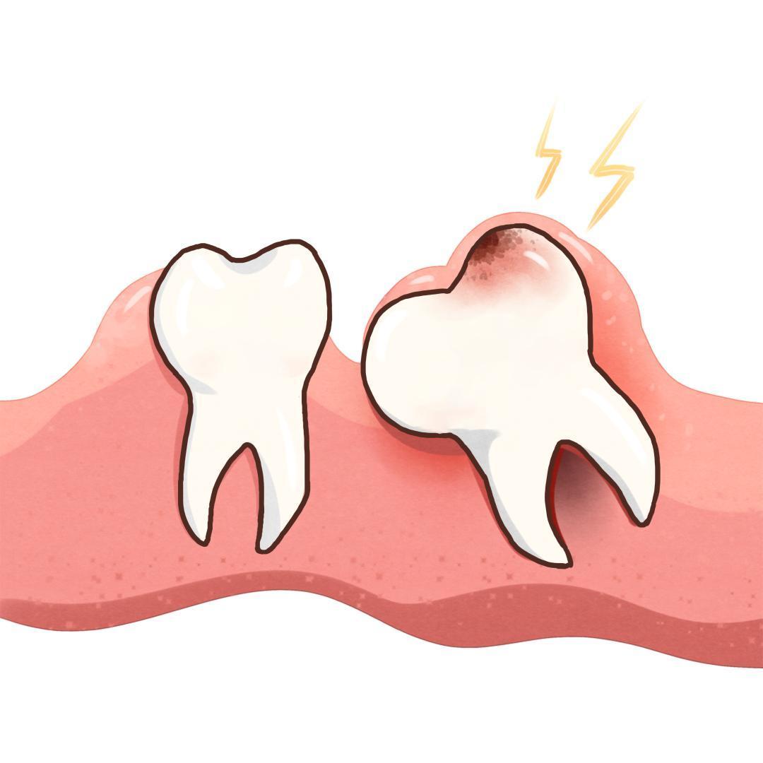 牙齿松动是什么样子？该如何治疗-爱康健齿科